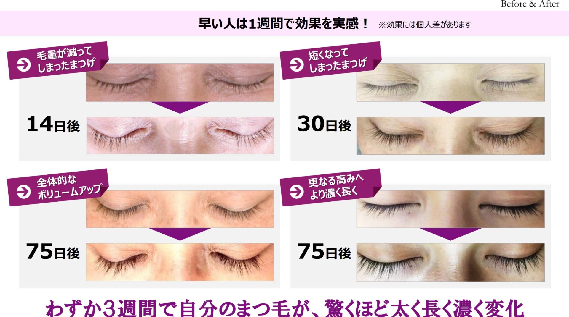 ラッシュアディクトとは？効果と色素沈着の真相・偽物の見分け方を徹底検証