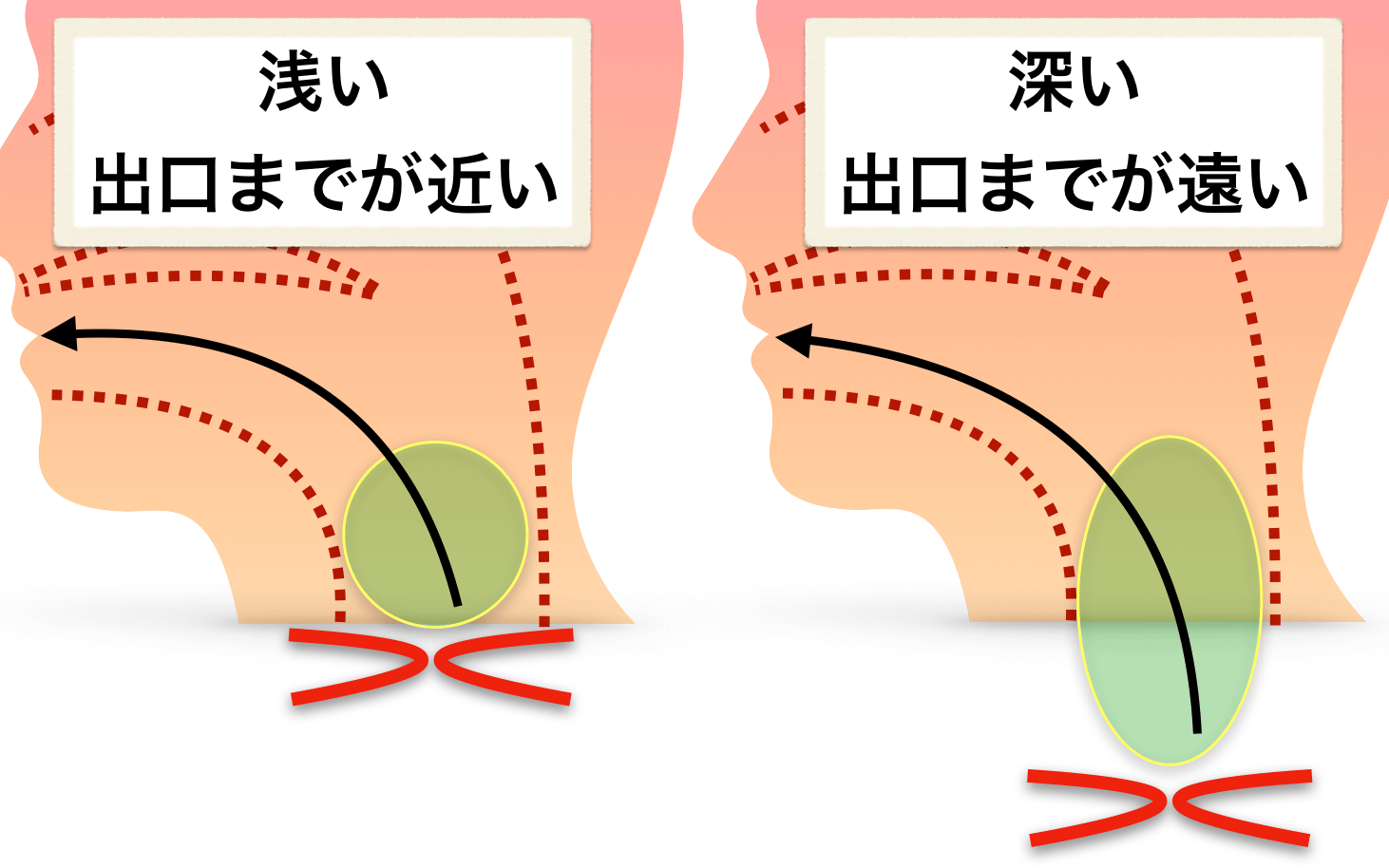 声がこもる原因を徹底解明！プロ直伝の通る声改善トレーニング