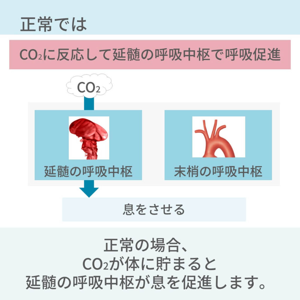 Co2ナルコーシスとは？良かれの酸素で呼吸停止を招く恐怖と対策