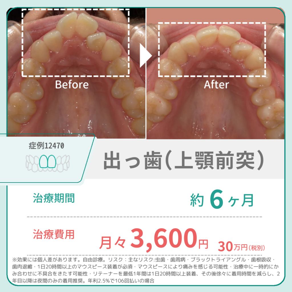 オーマイティースはやばい？通院不要の落とし穴と後悔しない全真相