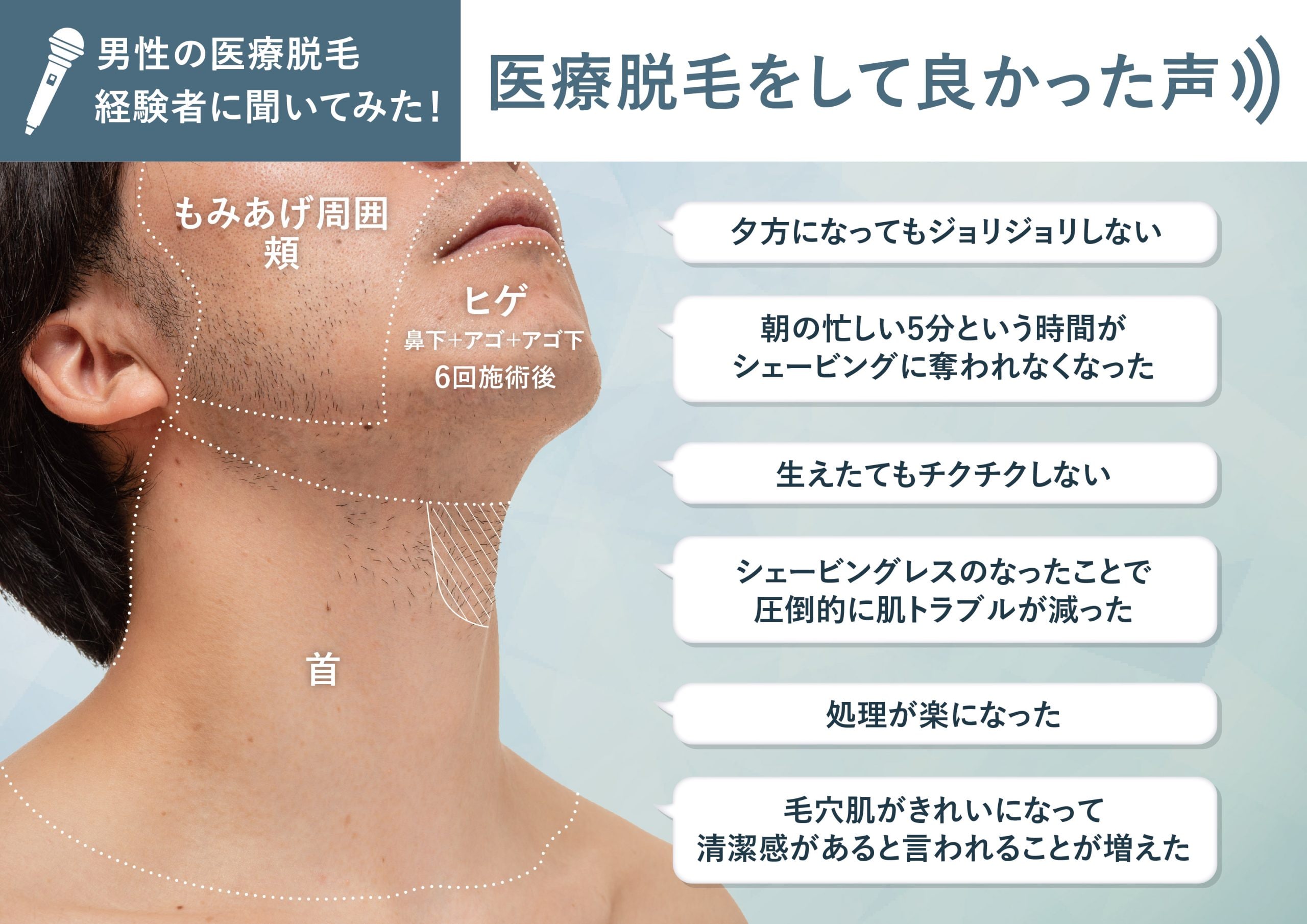 湘南美容外科のヒゲ脱毛は効果ない？後悔する人の特徴と2026最新料金の真相