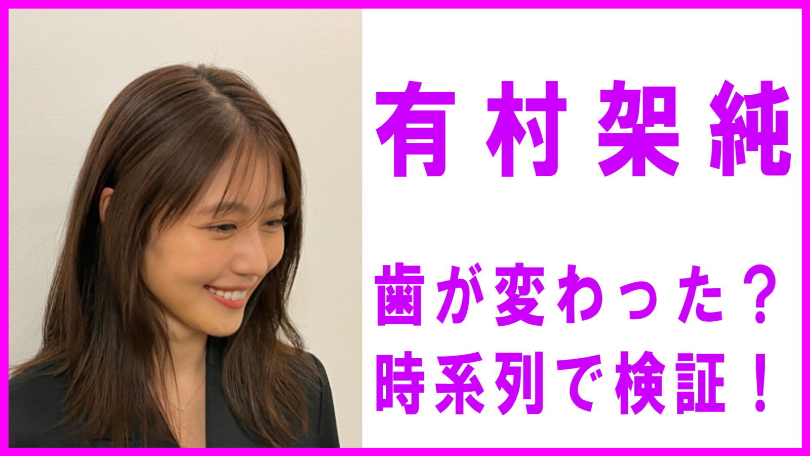 有村架純の歯並び変化を検証！矯正かセラミックか年代別画像で迫る真相