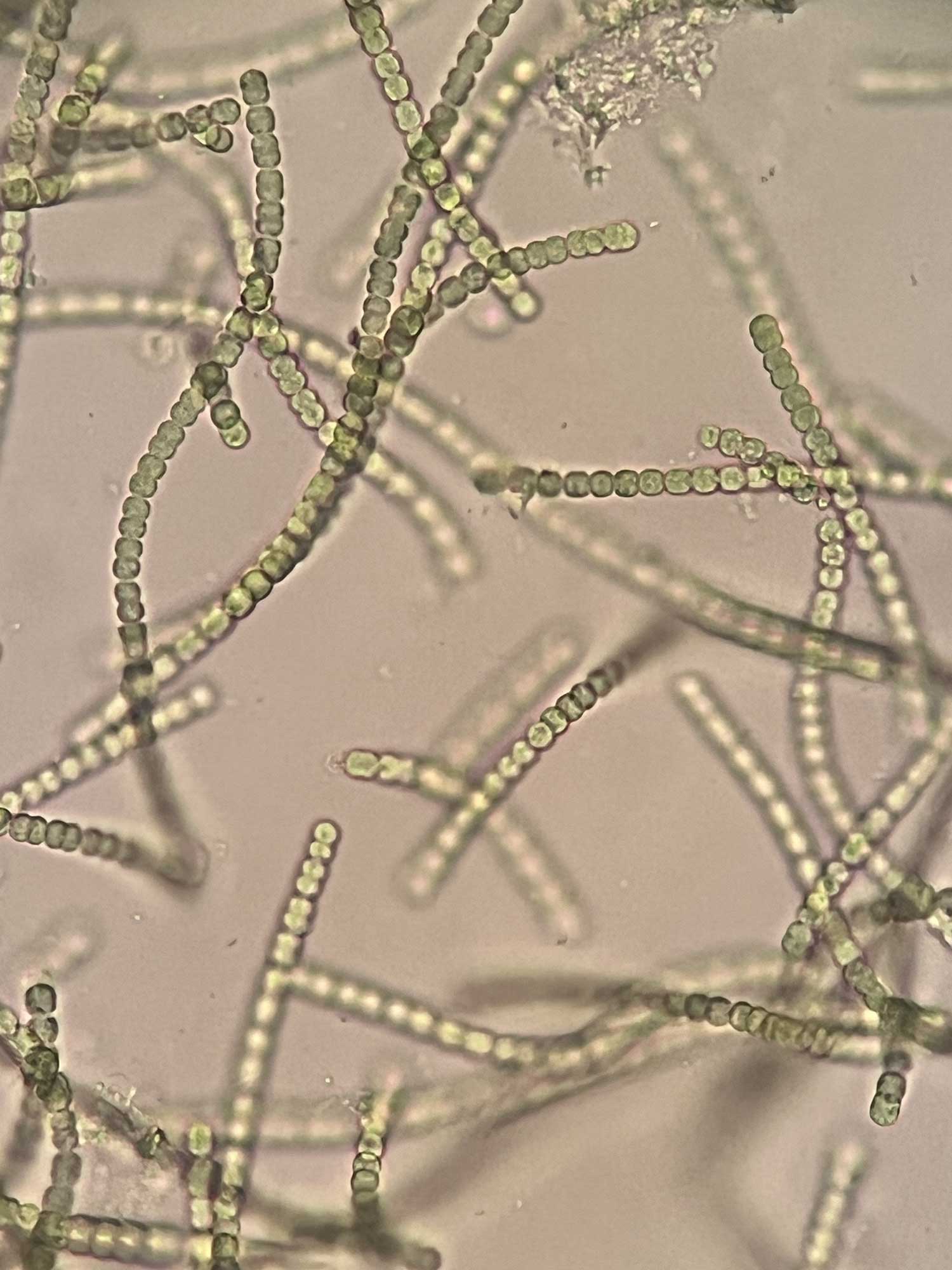 庭の謎のブヨブヨ「イシクラゲ」正体と芝生を傷めず撃退する全知識