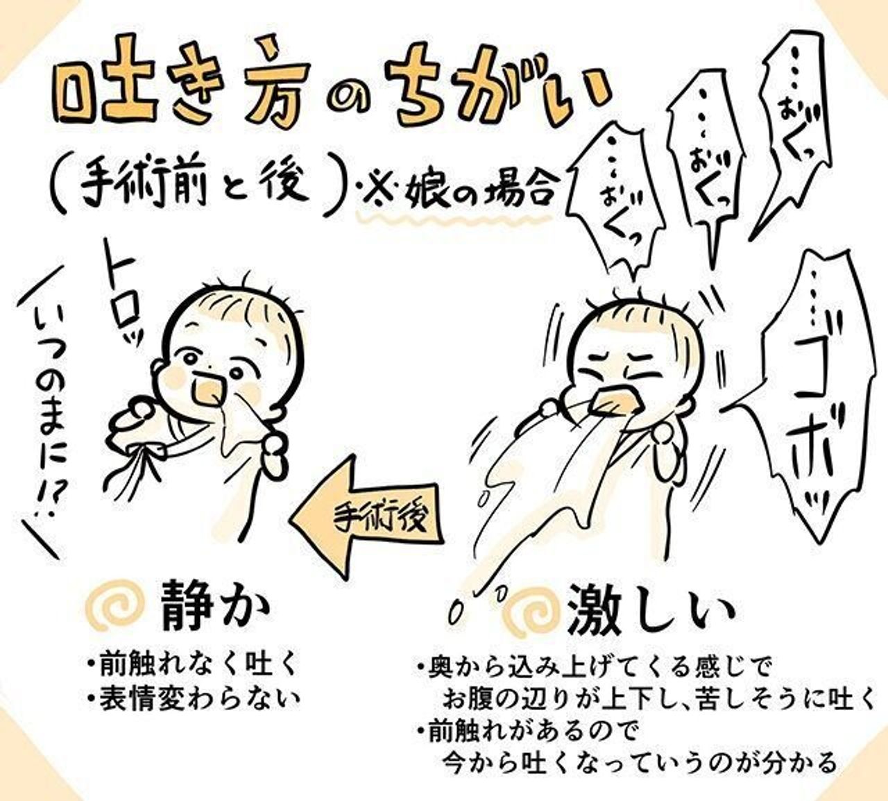 赤ちゃんがミルクを吐く原因と危険サイン｜受診の目安を徹底解説
