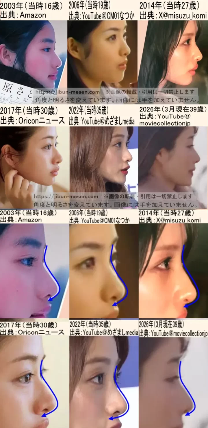 石原さとみ整形疑惑の真相！昔と現在の顔変化と垢抜けの決定打
