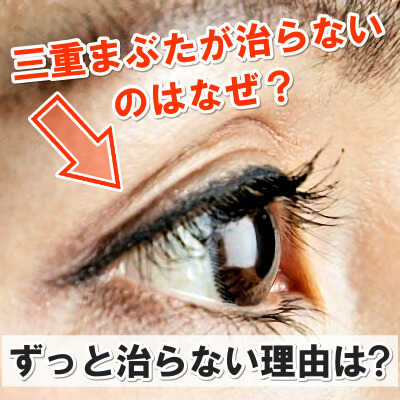 【熱愛】 片目 三重 治ら ない 私服＆私生活最新ショット #916