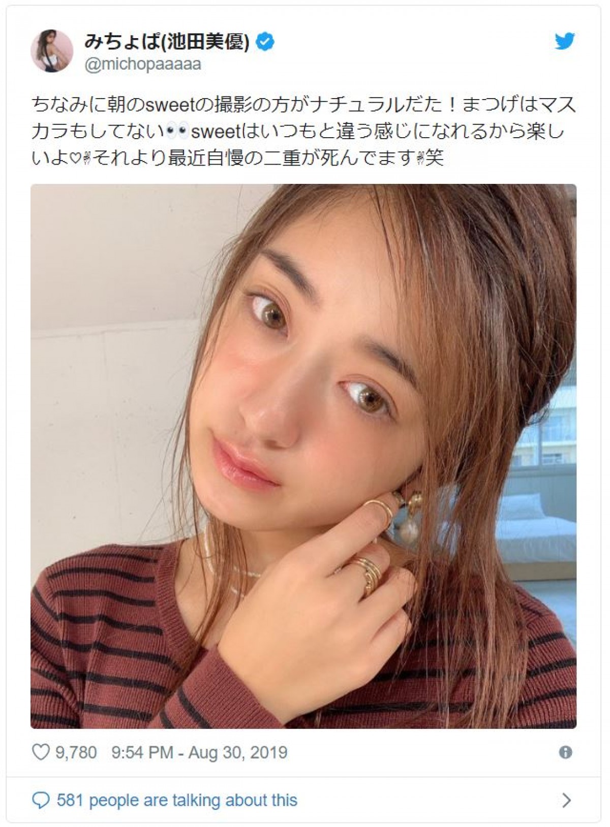 みちょぱのすっぴんが別人？素顔公開で見えた美肌の真相と夫の反応