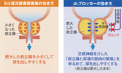 【Wiki風】 前立腺 が ん 予防 射精 2026年最新芸能速報 #665