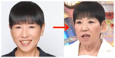 【衝撃】 和田 アキ子 眼瞼 下垂 経歴＆学歴まとめ 2026 #787