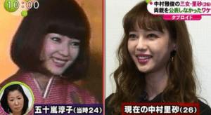 【話題】 中 村里 砂 整形 前 2026年最新メディア #663