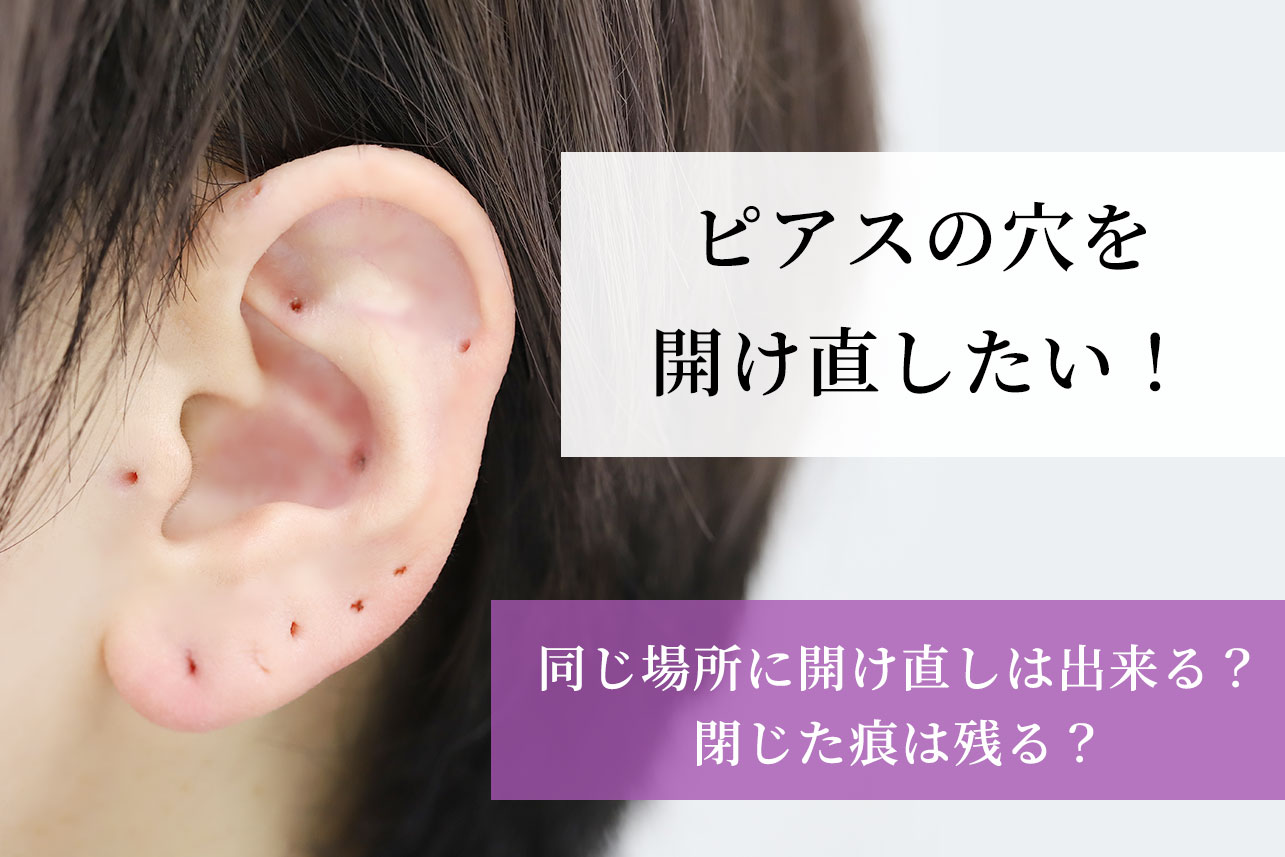 ピアス開け直しはいつから可能？失敗を防ぐ期間と皮膚科の費用相場