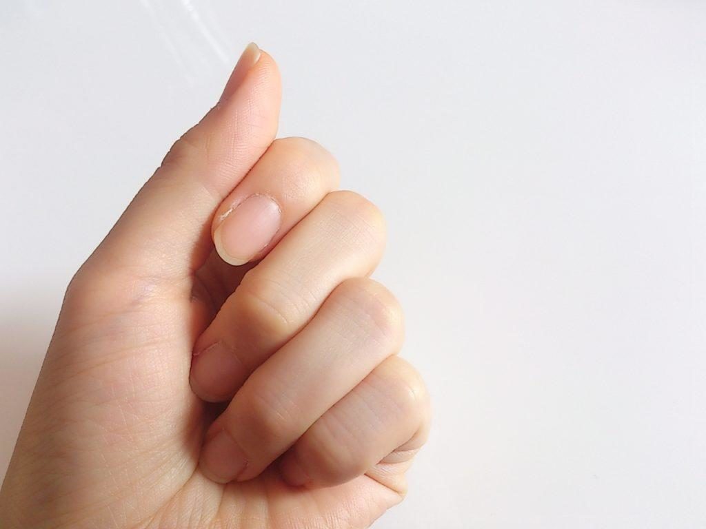 爪に白い点ができる原因は病気？幸運の噂の真相と受診の目安を徹底解説