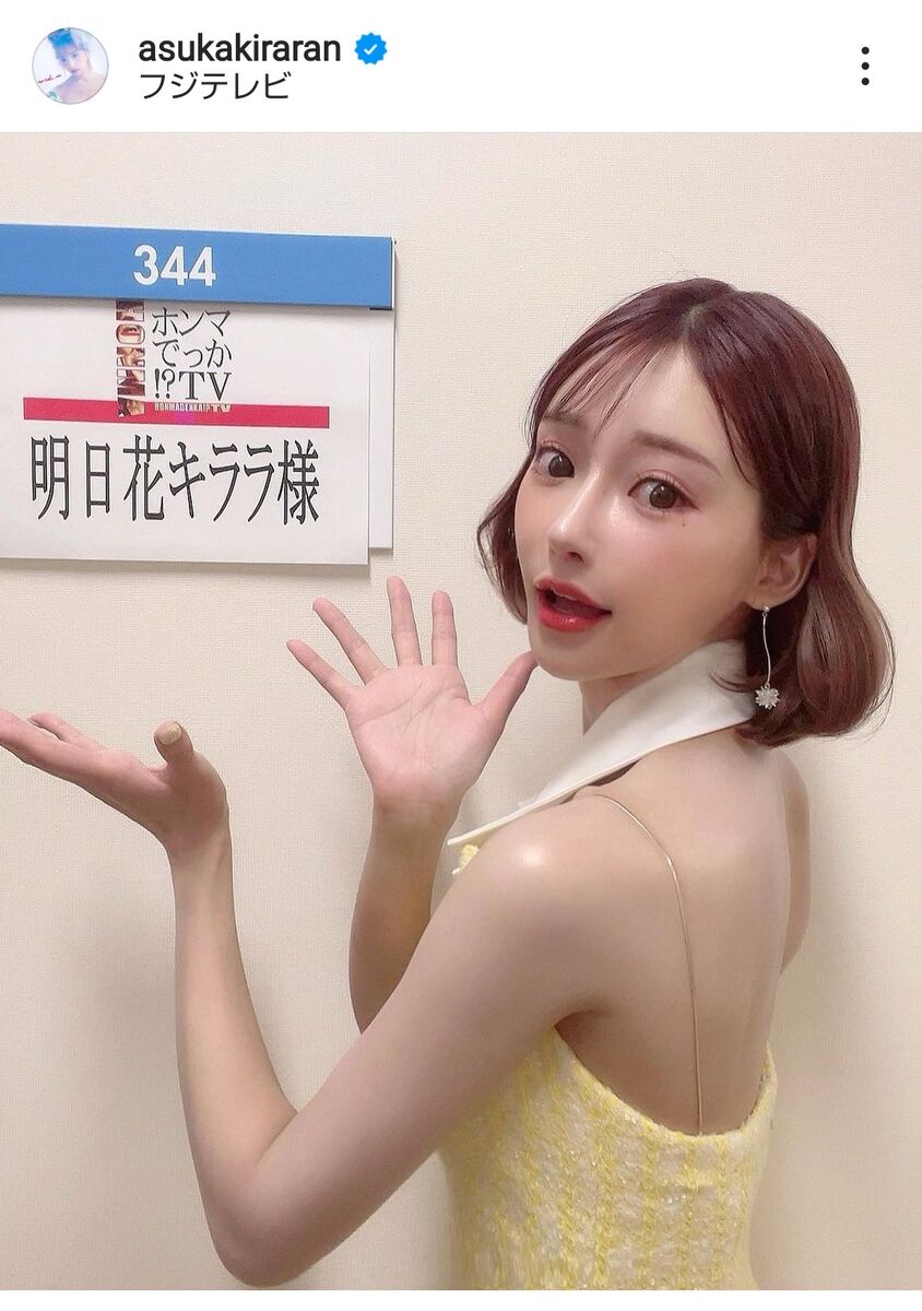 明日花キララの整形公表と昔の顔比較！費用や担当医・現在の変化の真相