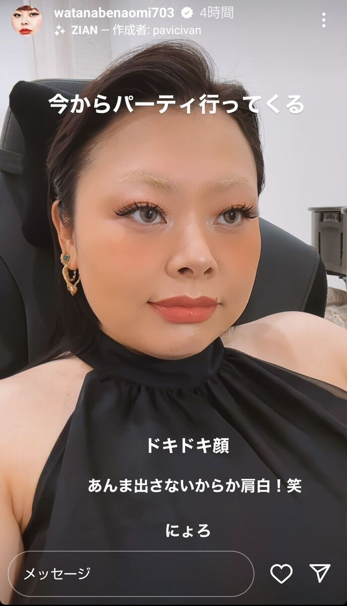 渡辺直美が痩せた理由とは？20Kg減量の真相と現在の体重・体型変化