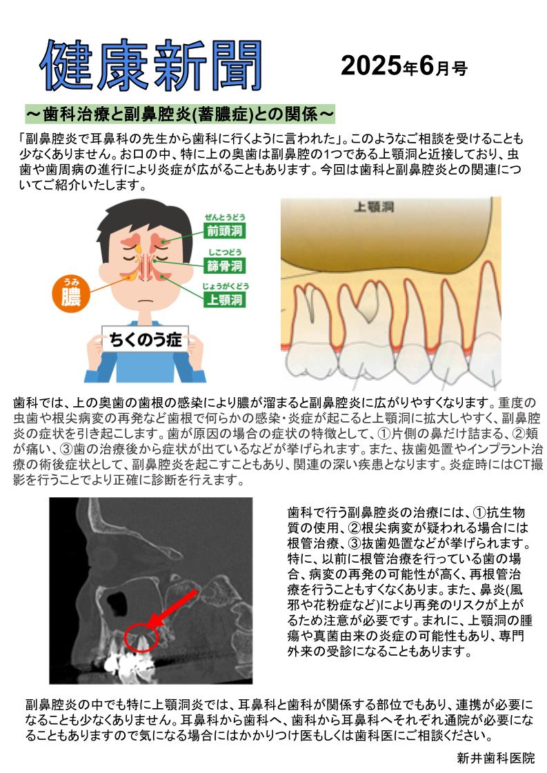 治らない副鼻腔炎は虫歯が原因？片側の鼻水・悪臭の正体と受診基準