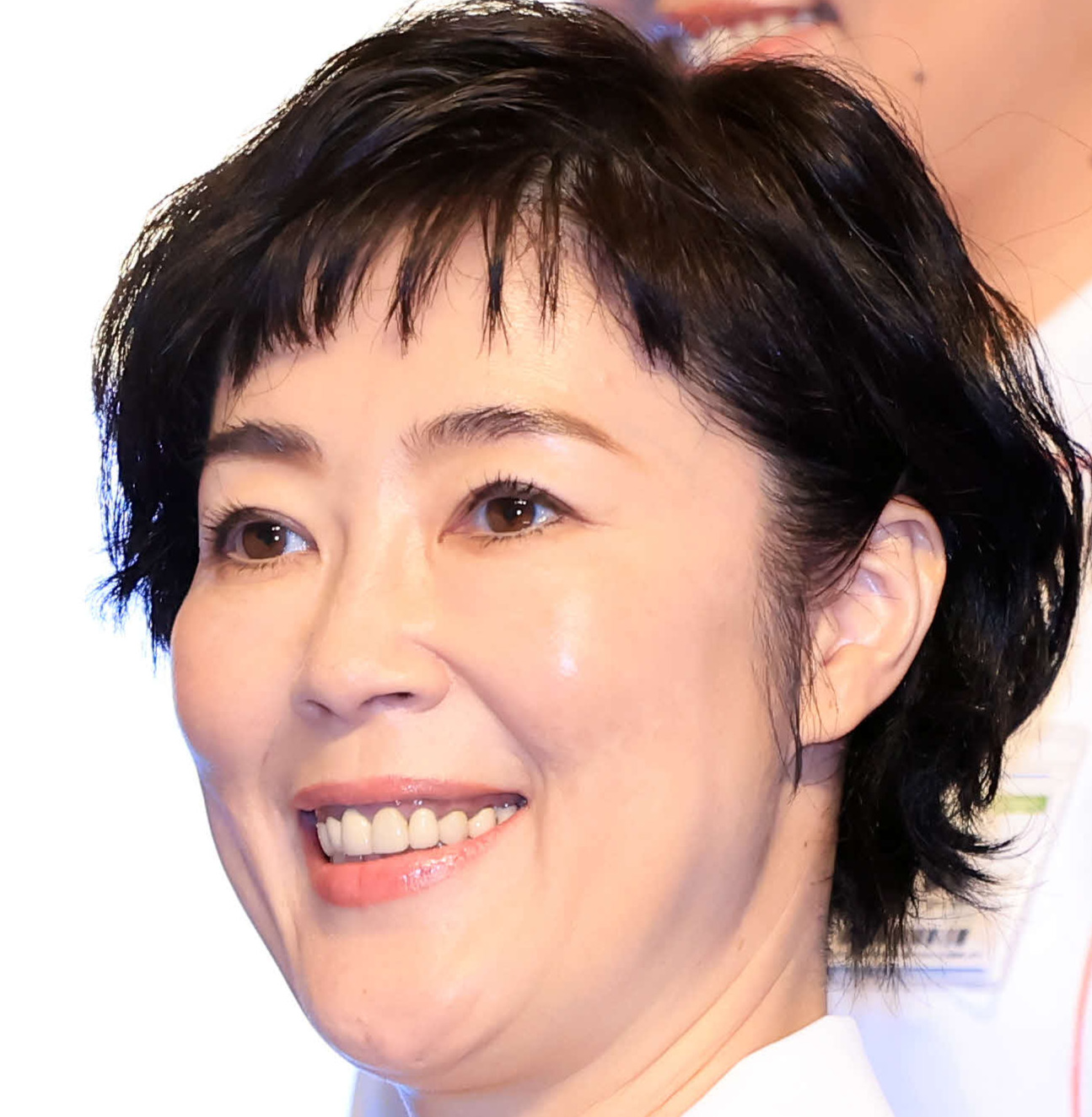 顔面神経麻痺を公表した芸能人の現在と原因！復帰への闘病と克服の全真相