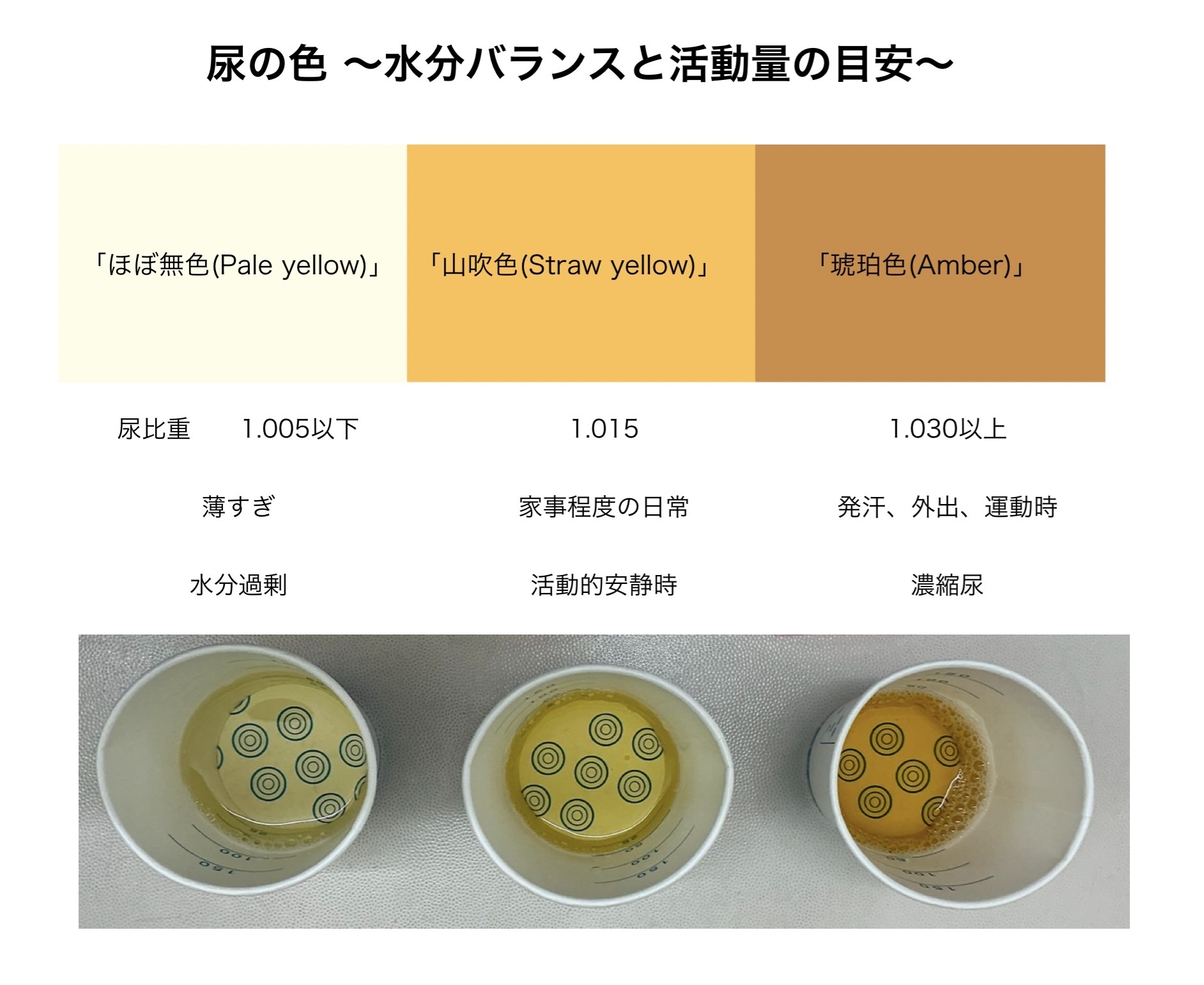 おしっこの色で危険度を見抜く！茶色や赤色の原因と病院受診の目安
