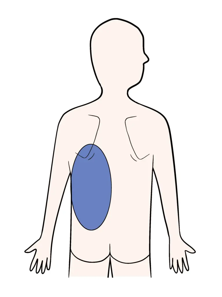 背中の痛みは心筋梗塞の前兆？筋肉痛との見分け方と救急基準を徹底解説