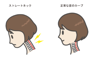 【噂】 ストレート ネック 治し 方 ためして ガッテン 最新情報まとめ 2026 #845