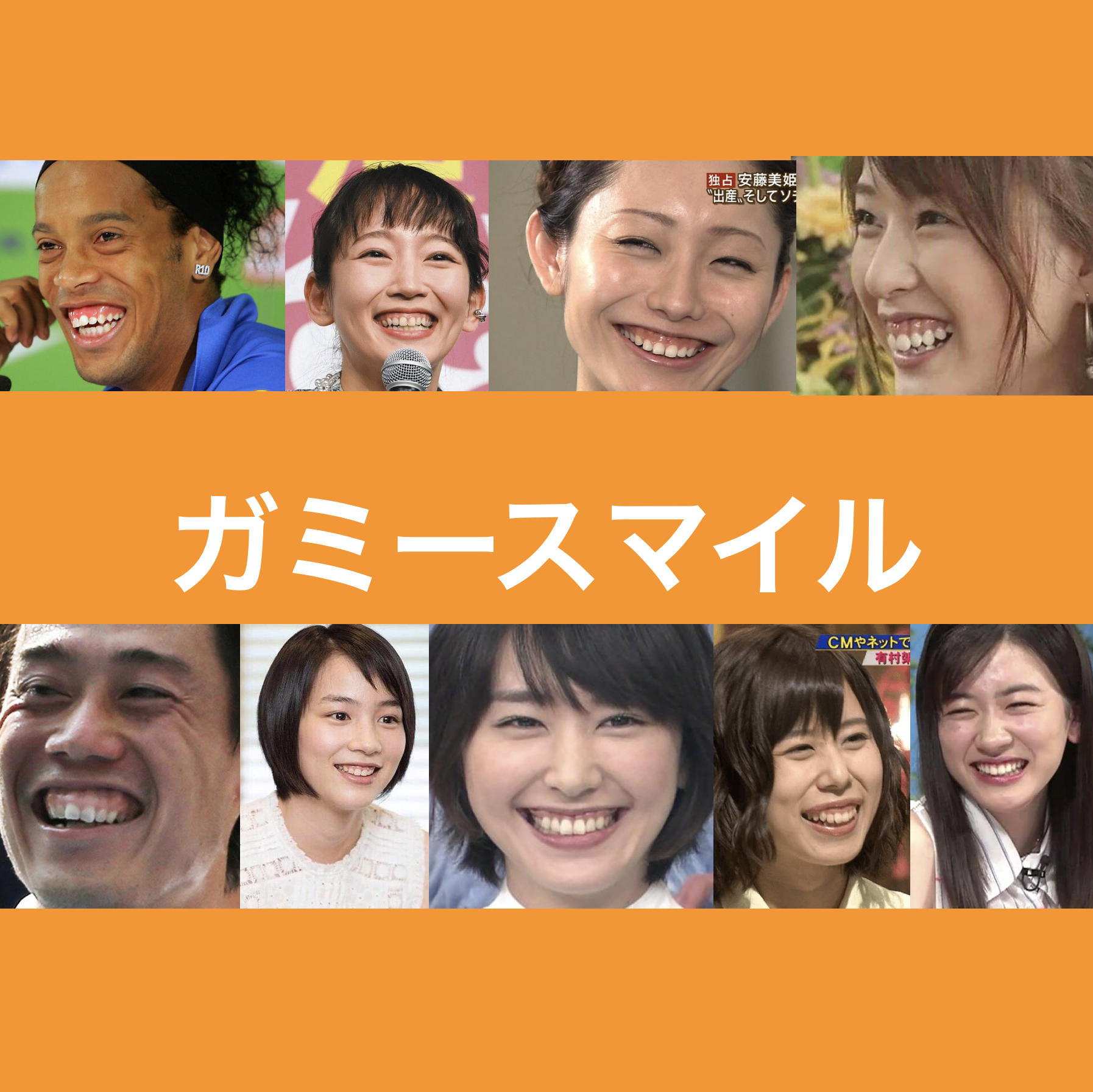 ガミースマイル芸能人の真実｜愛される魅力と治療で治した真相