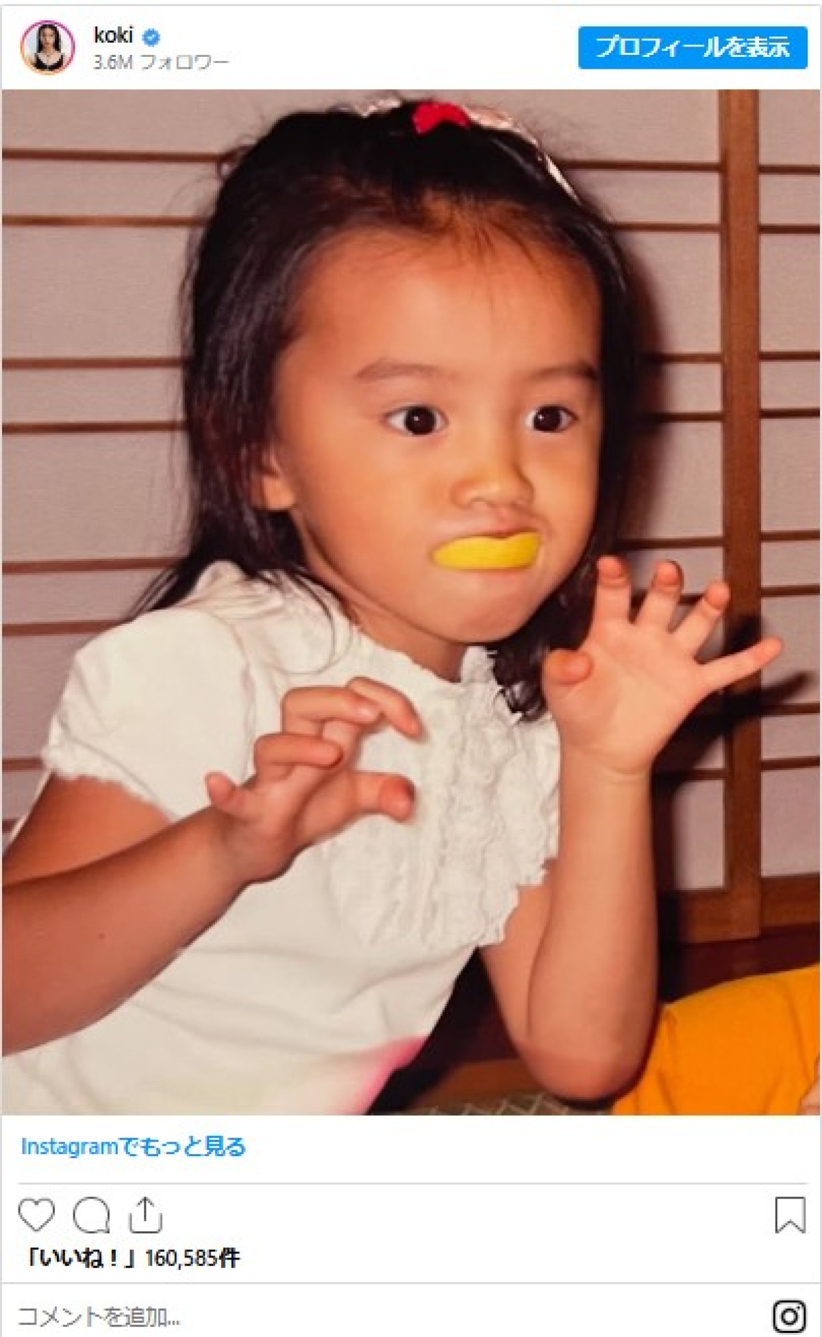 人気芸能人の幼少期と生い立ちの真実！面影・激変と苦労話を徹底解剖