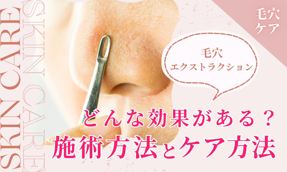 毛穴エクストラクションの真実｜角栓除去の罠と失敗リスクを徹底検証