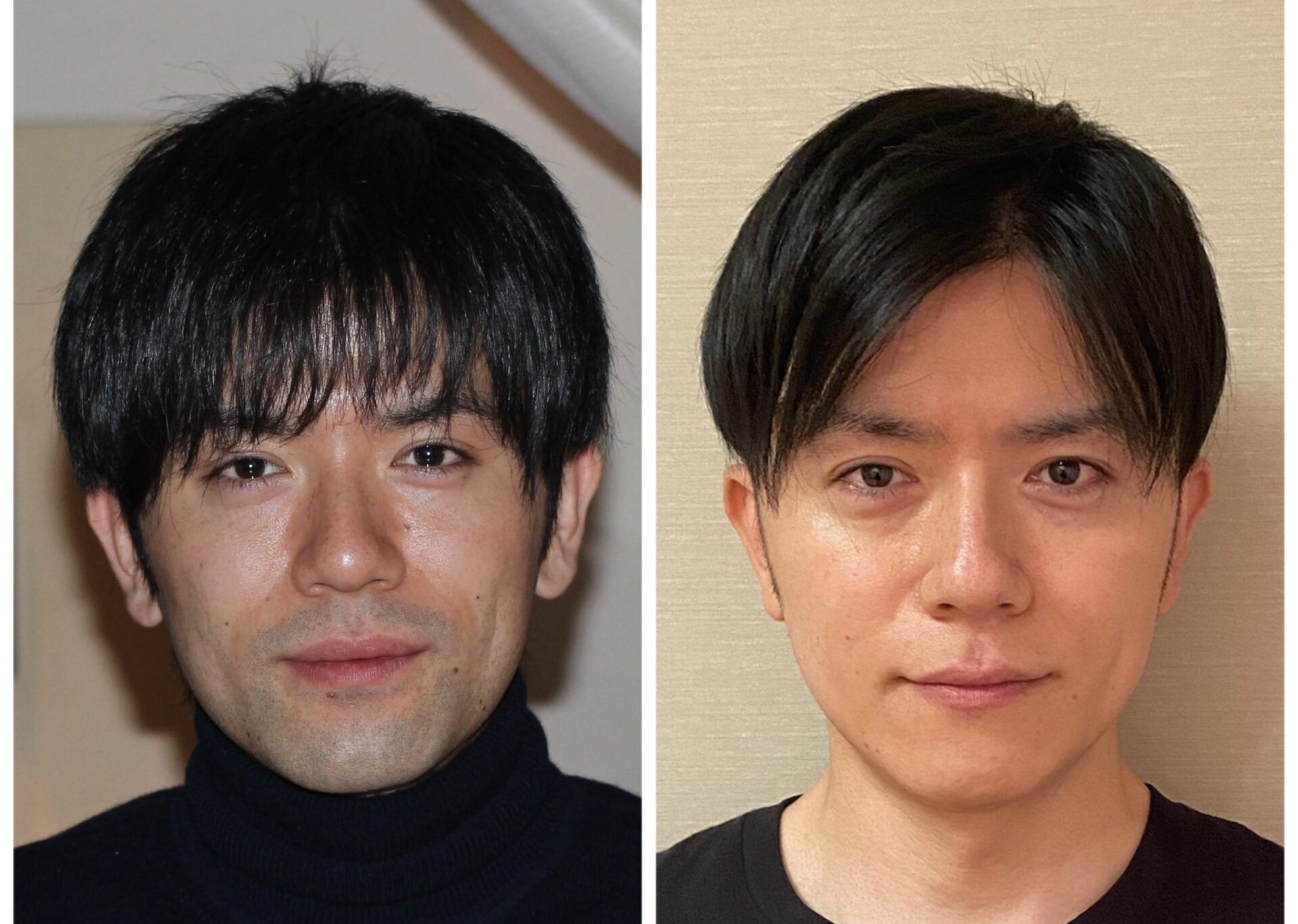 青髭は治る？ホンマでっかTvで話題の真相と科学的対策を徹底検証