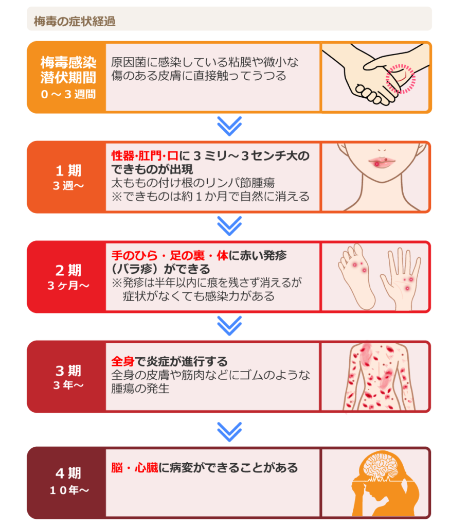 梅毒の皮膚症状、かゆみなし赤斑が消えても放置が危険な真相