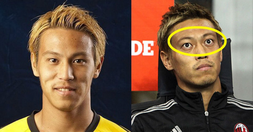 本田圭佑の病気の真相と甲状腺手術痕の噂！現在の健康状態を徹底検証