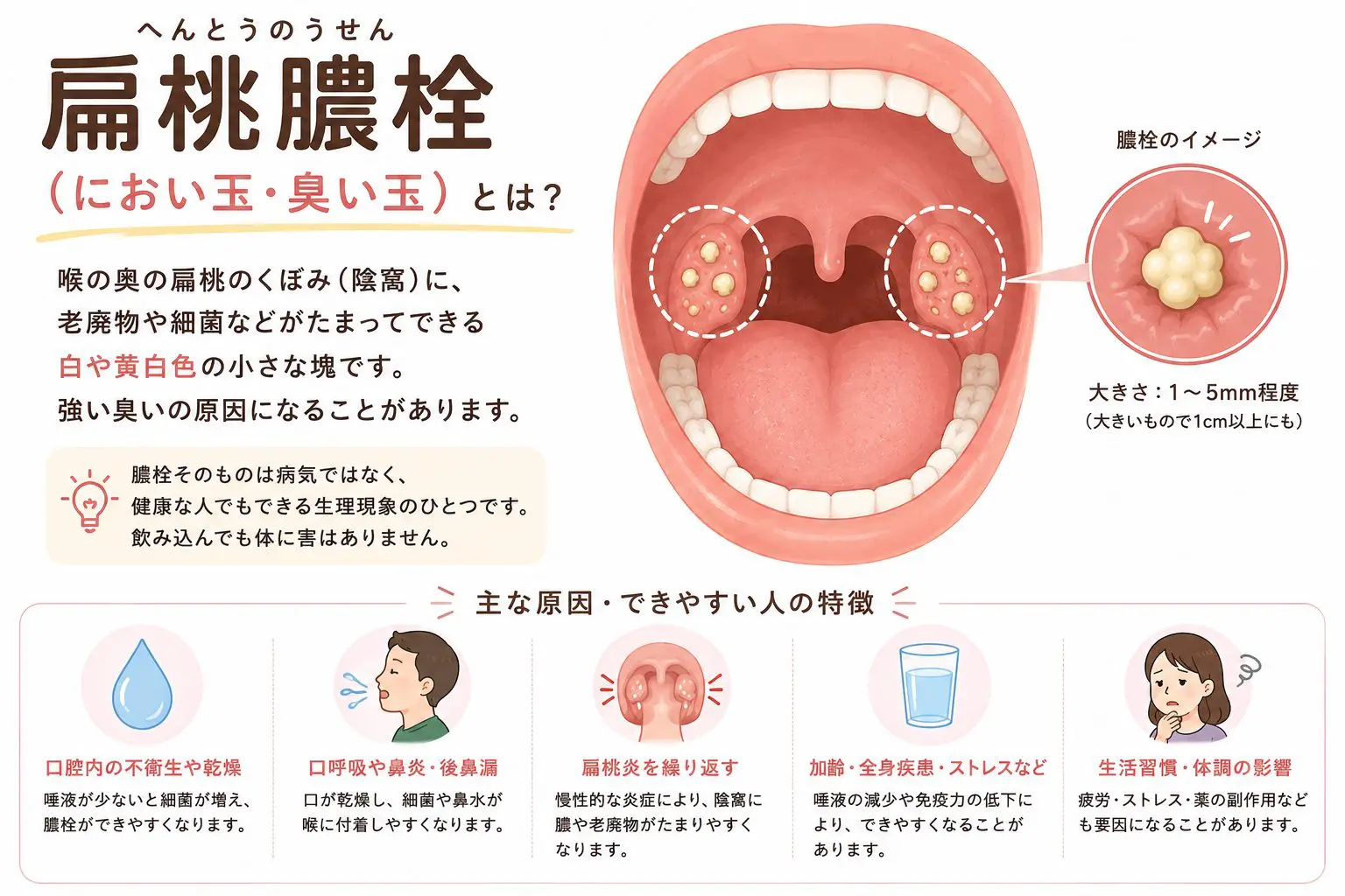 喉の奥の悪臭「臭い玉」とは？自力除去の罠と耳鼻科医が語る撃退法