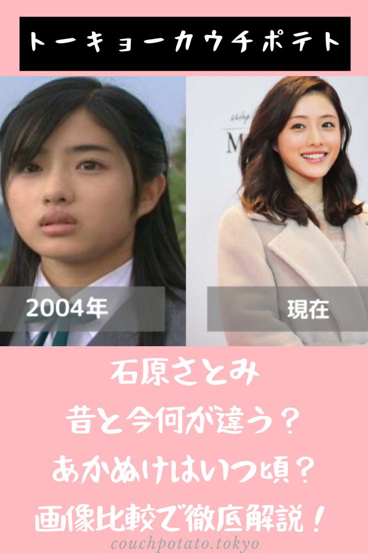 石原さとみの昔が可愛すぎる！劇的変化と垢抜けた真の理由を徹底解剖