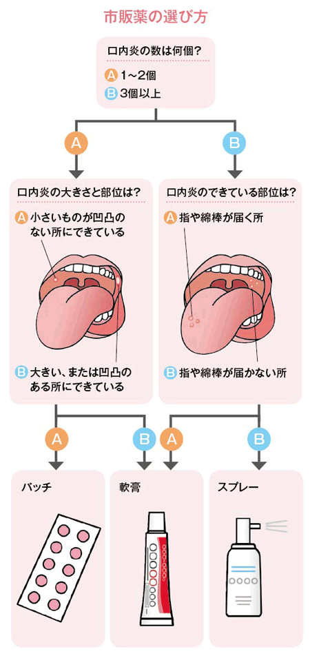 【2026最新】激痛口内炎を今すぐ何とかしたい！即効で和らげる応急処置と歯科医が認める裏ワザ大全