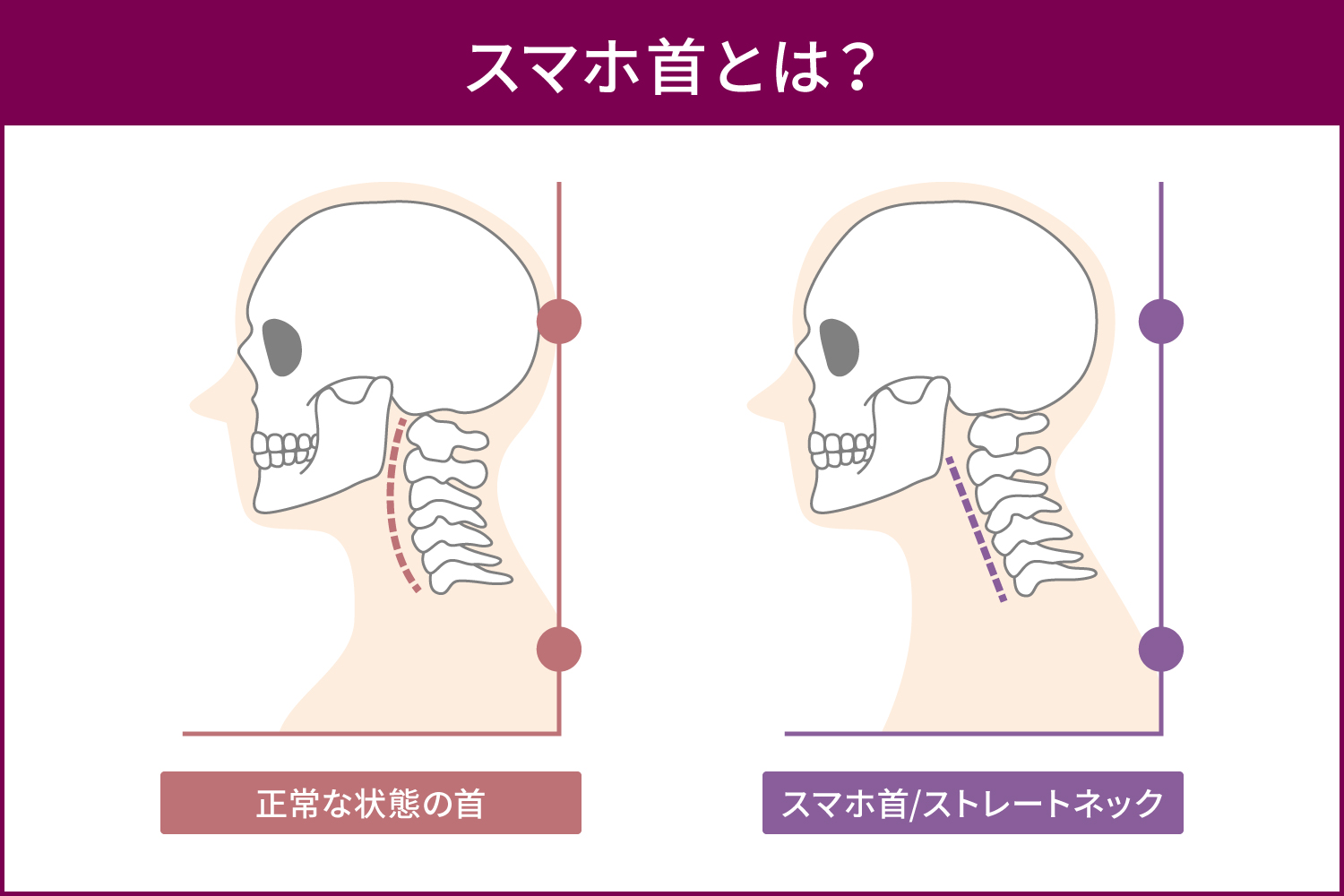 顎下のたるみを即効撃退！急増する原因とプロが教える解消法完全ガイド
