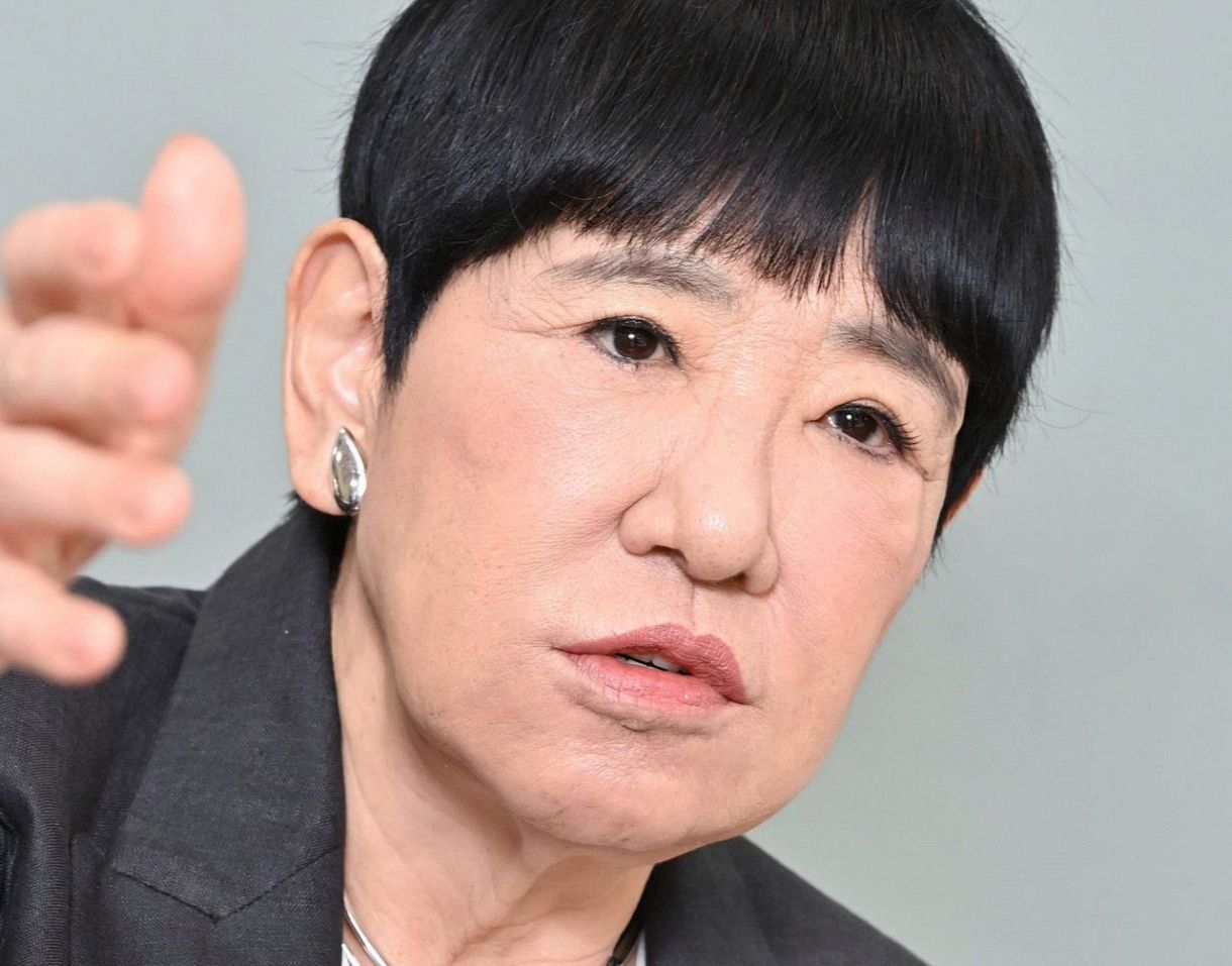 和田アキ子の目に何が？整形疑惑と眼瞼下垂手術の苦悩、現在の姿まで