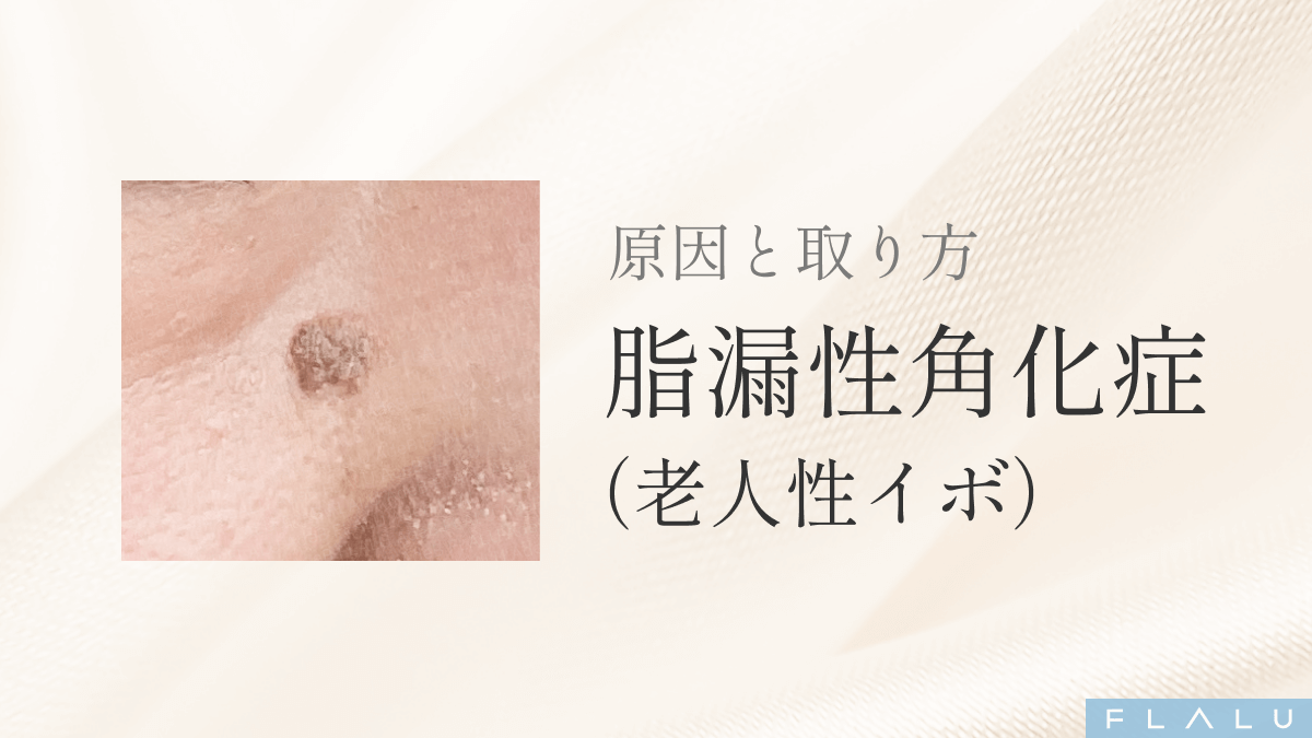 老人性イボの写真徹底比較！悪性腫瘍との違いと2026年最新治療法
