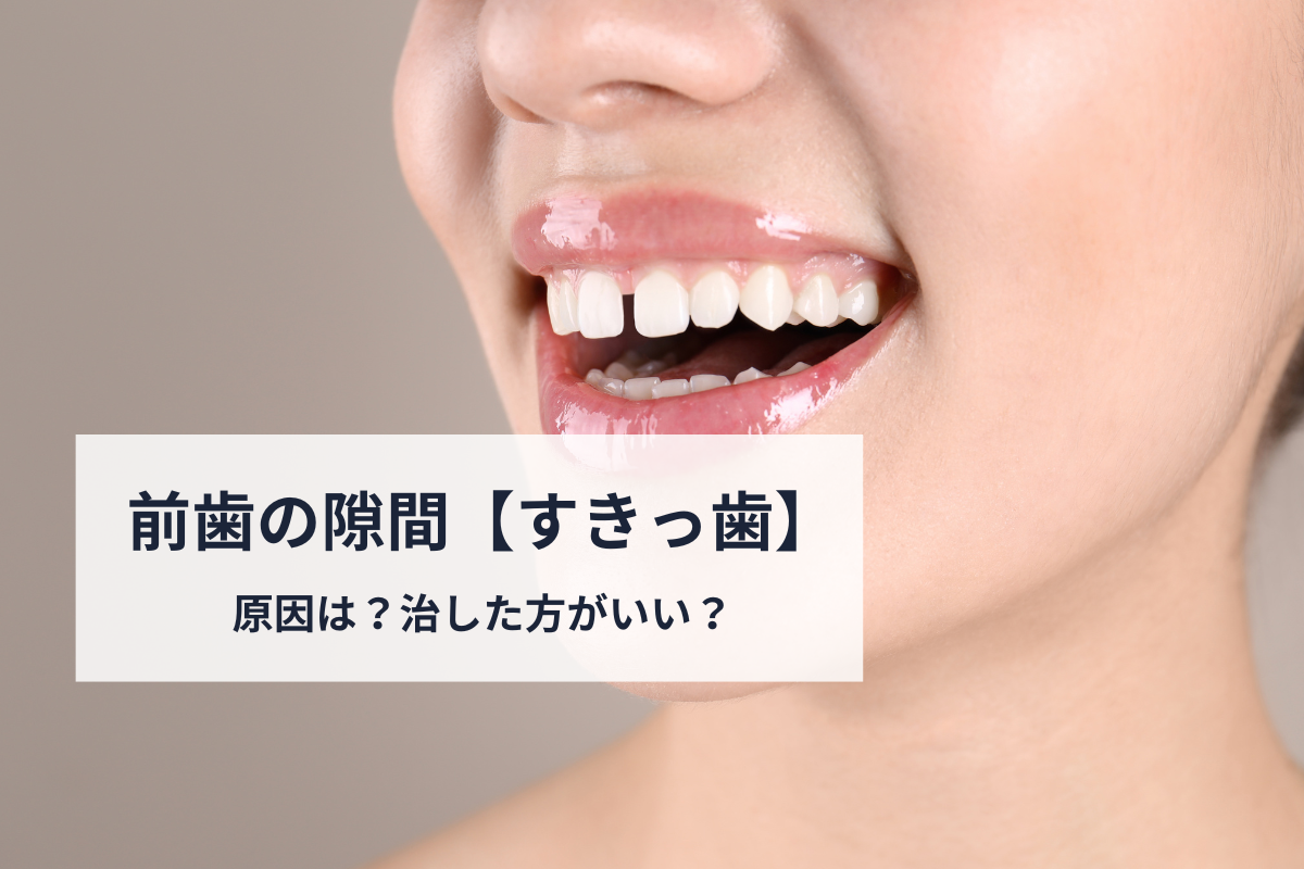 すきっ歯芸能人の魅力と治さない理由｜男女別一覧と幸運の人相学を徹底検証