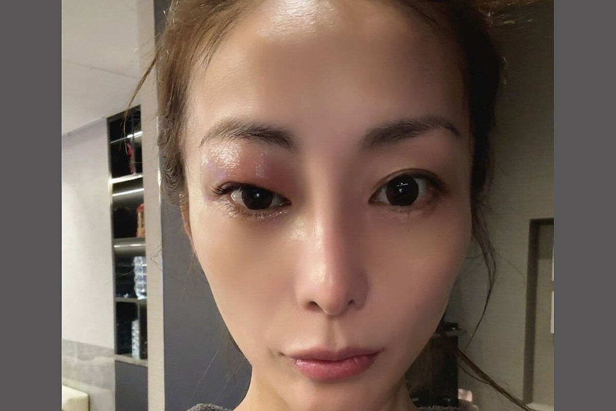 腫れぼったい目の芸能人が今愛される理由｜厚いまぶたの垢抜け真相