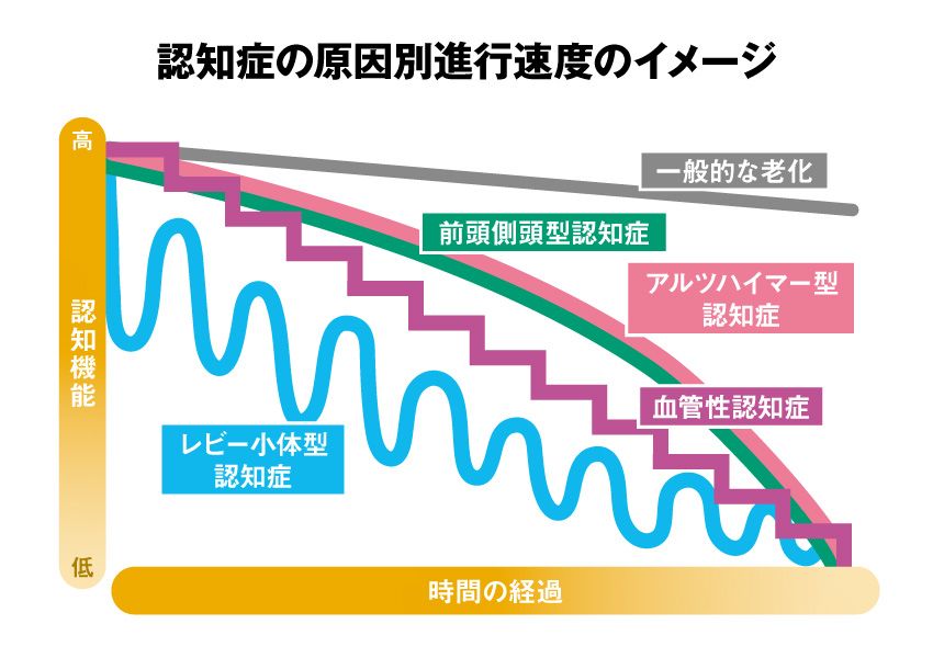 認知症の進行速度が急変する理由とは？2026年最新の兆候と家族の対応