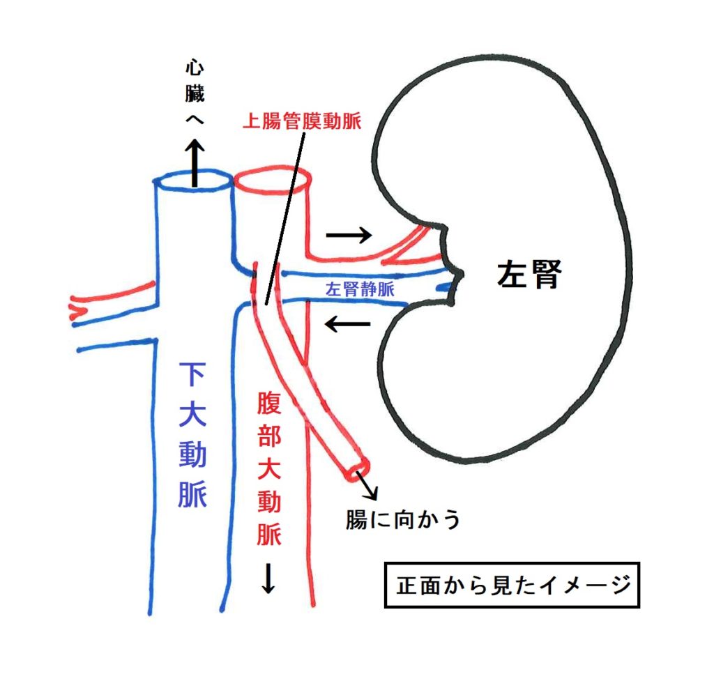 ナットクラッカー症候群の真相｜痩せ型を襲う血尿と左脇腹痛の治し方