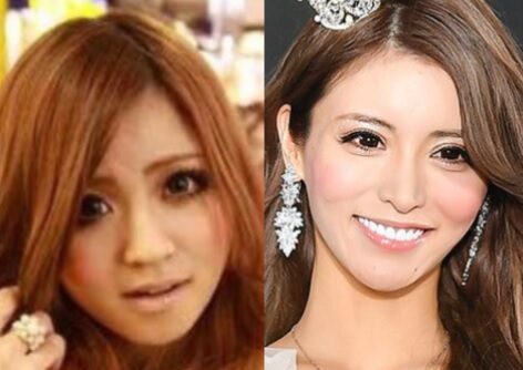 【話題】 一条 響 整形 前 最新ファイル＆画像まとめ #748
