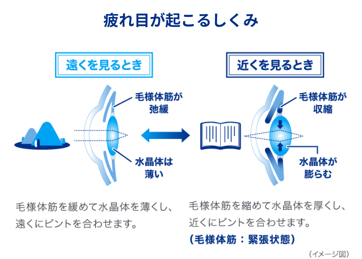 目がしょぼしょぼする原因と即効の治し方！重い病気のサインと目薬選び