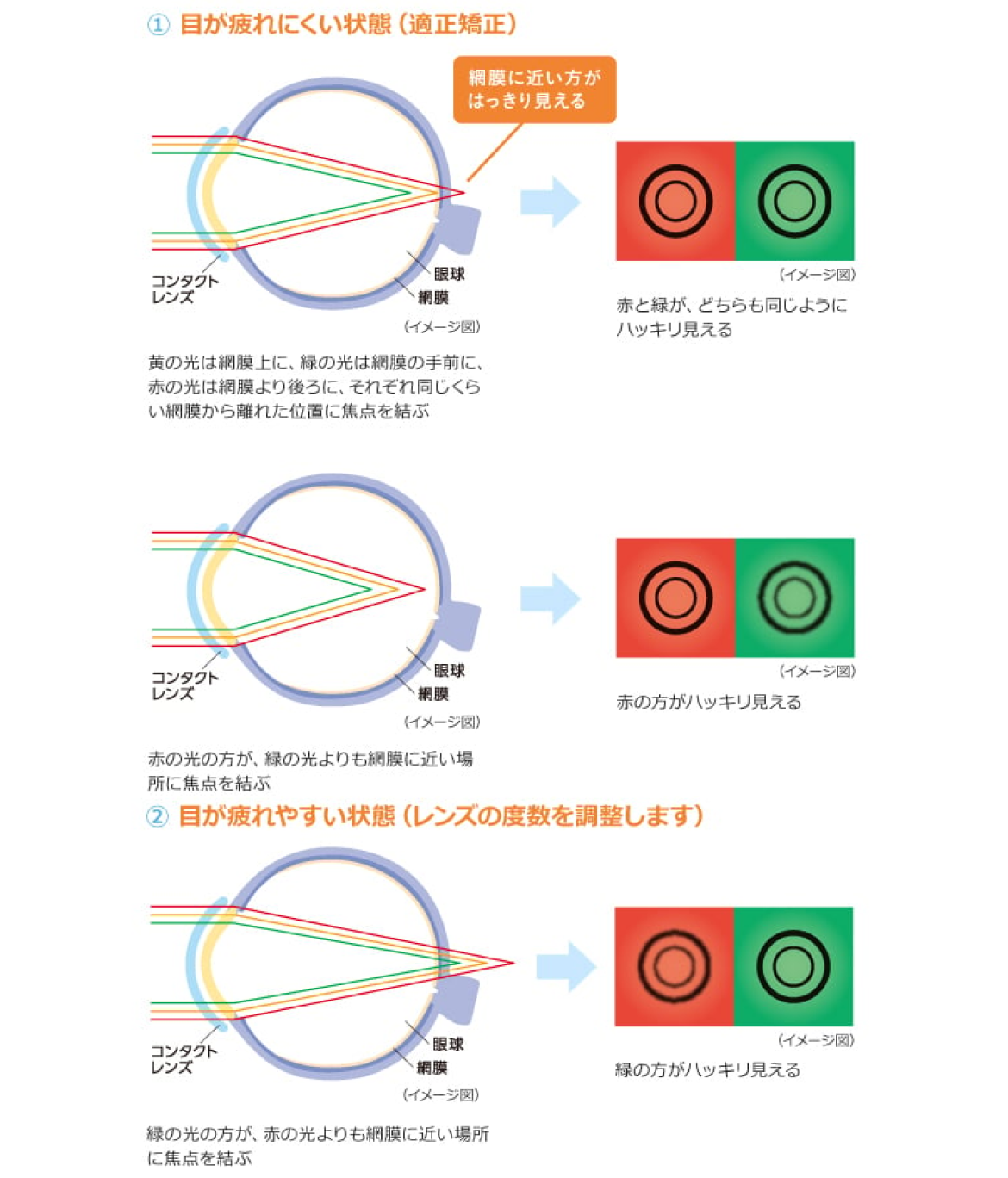 眼科の赤緑検査はどっちが正解？見え方の違いと過矯正を防ぐ判定基準