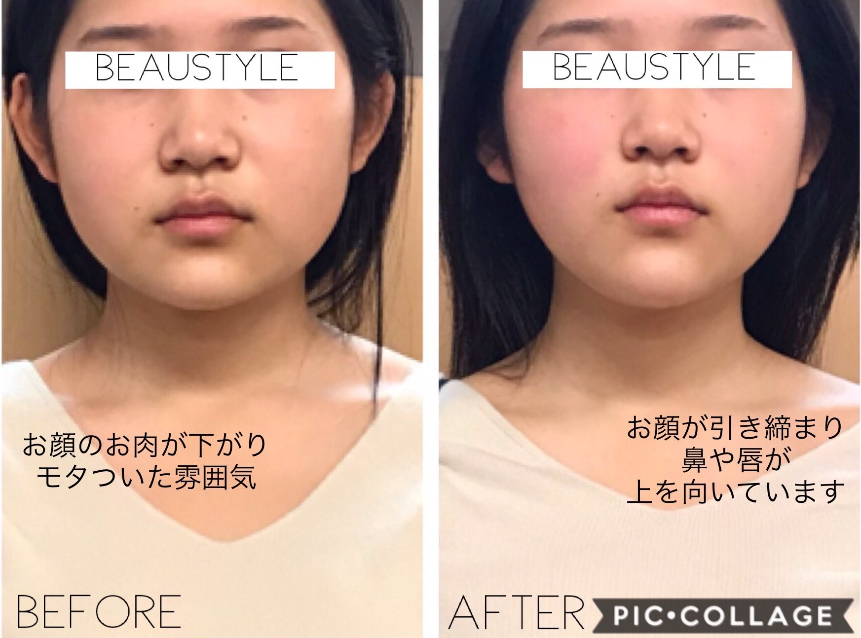 顔の左右非対称を直す決定打！歪みの真因と劇的セルフケア術2026