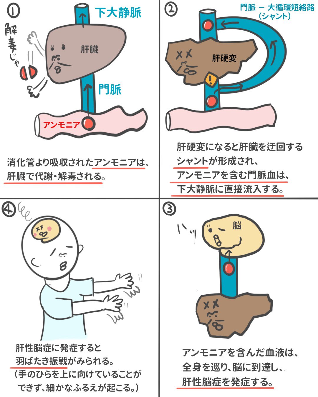 手がピクつく羽ばたき振戦の正体とは？肝硬変や腎不全の危険サイン