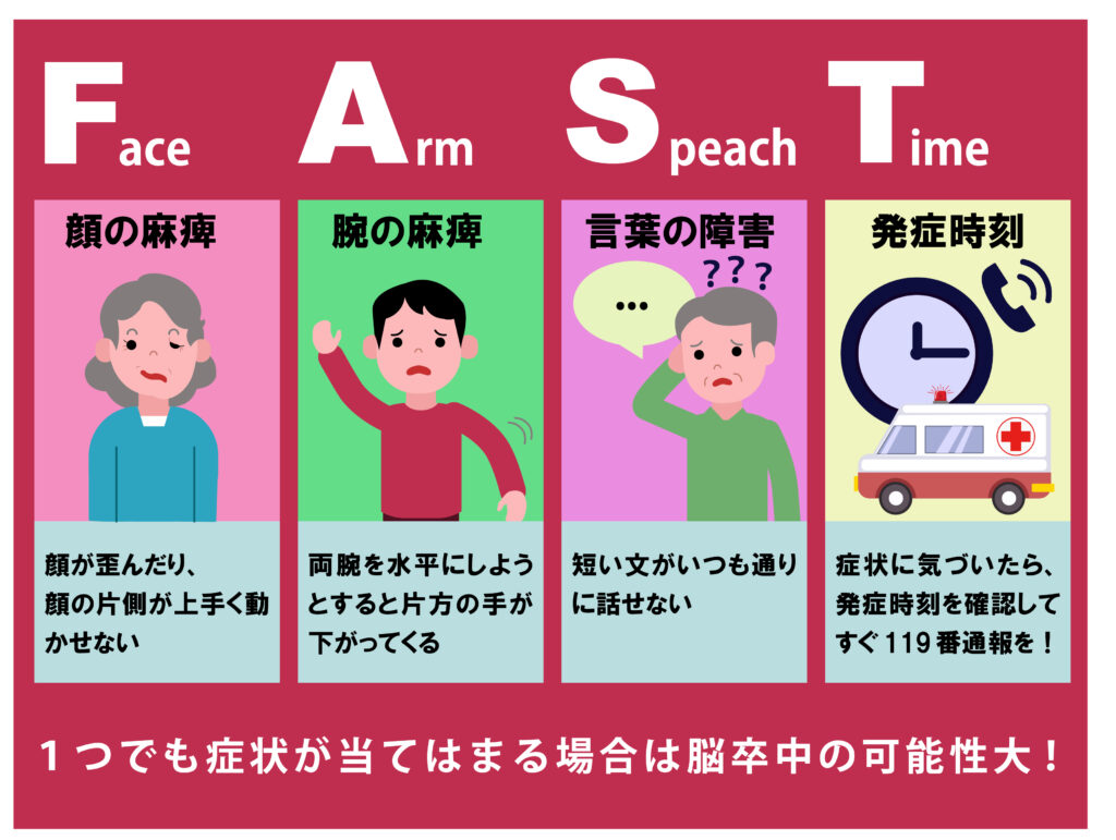 脳梗塞は本当に治る？後遺症の現実と劇的回復をもたらす最新治療の全貌