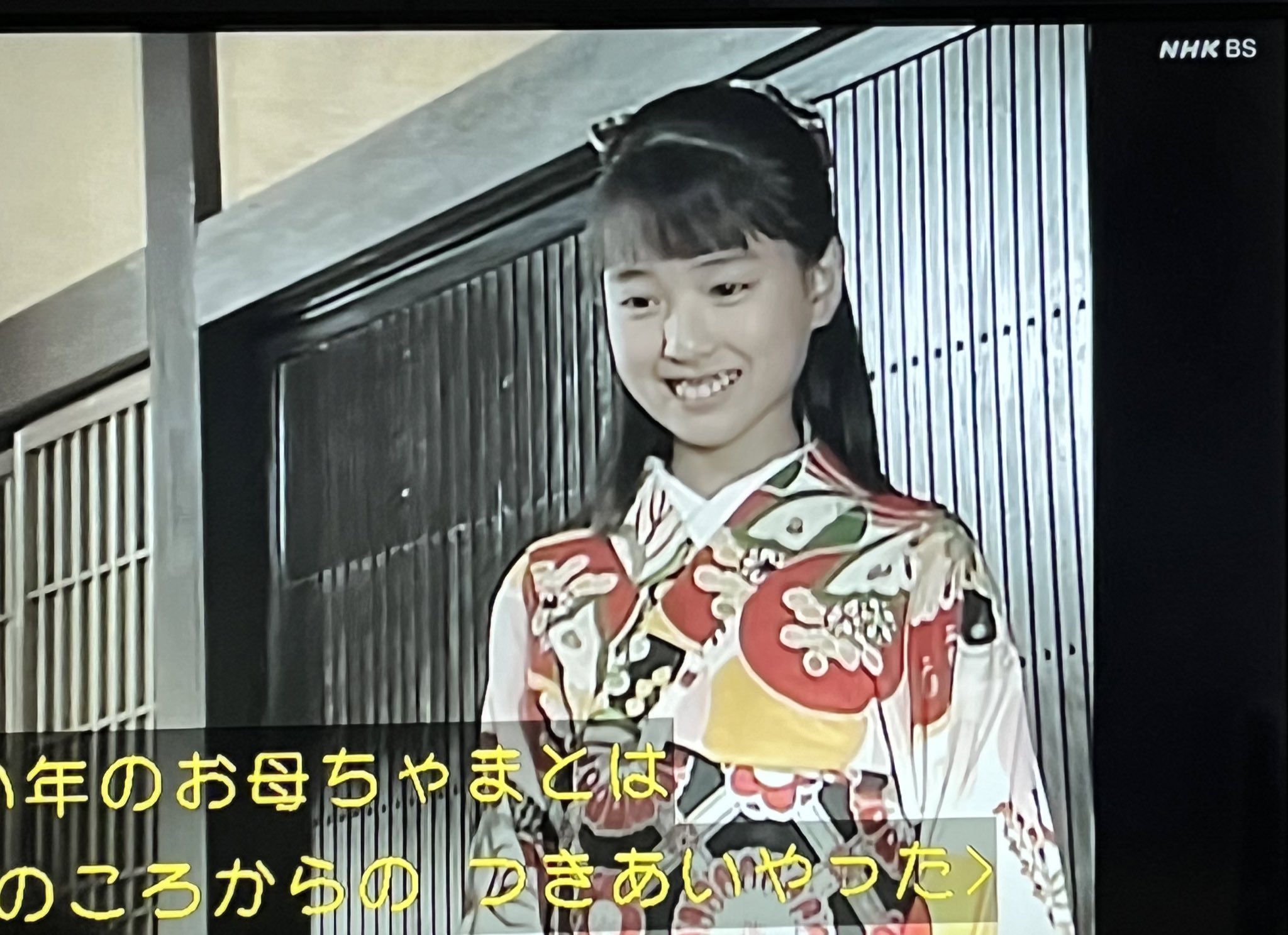 戸田恵梨香の子役時代と朝ドラ出演の真実｜初々しい原点と飛躍の転機