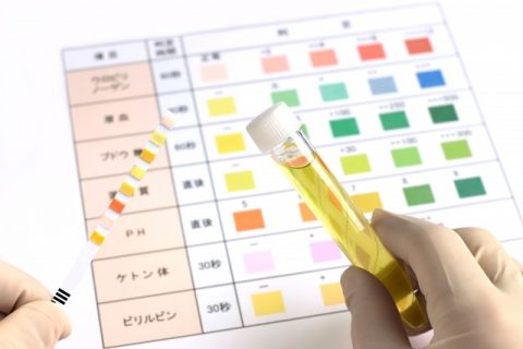 【衝撃】 尿 検査 生理 中 人気理由と評判まとめ #960