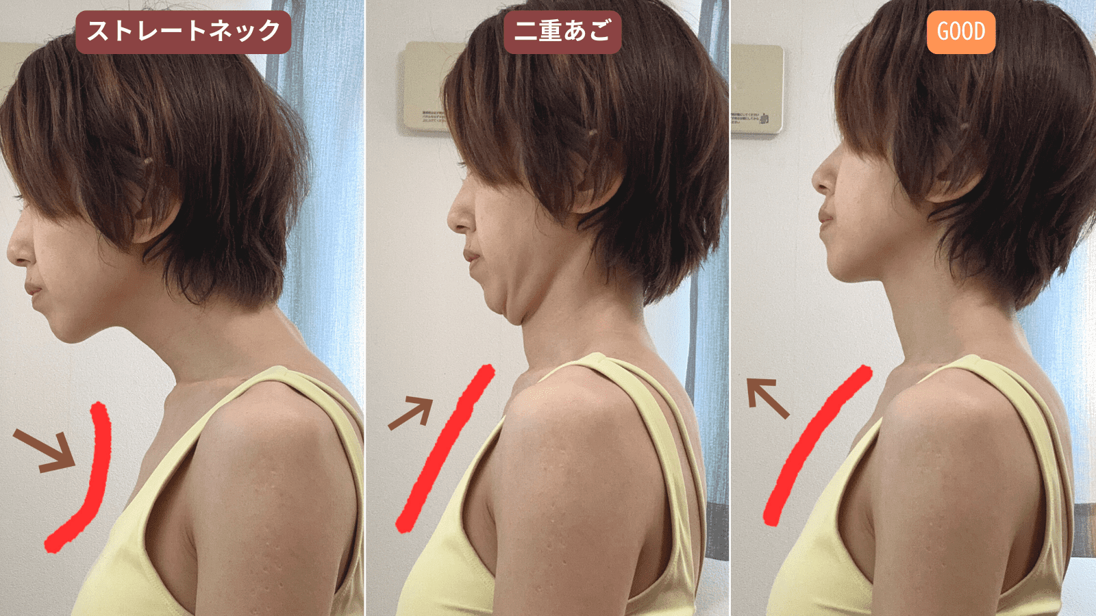 顎を引くと首が痛い？逆効果の真相と2026年最新の正しい改善法