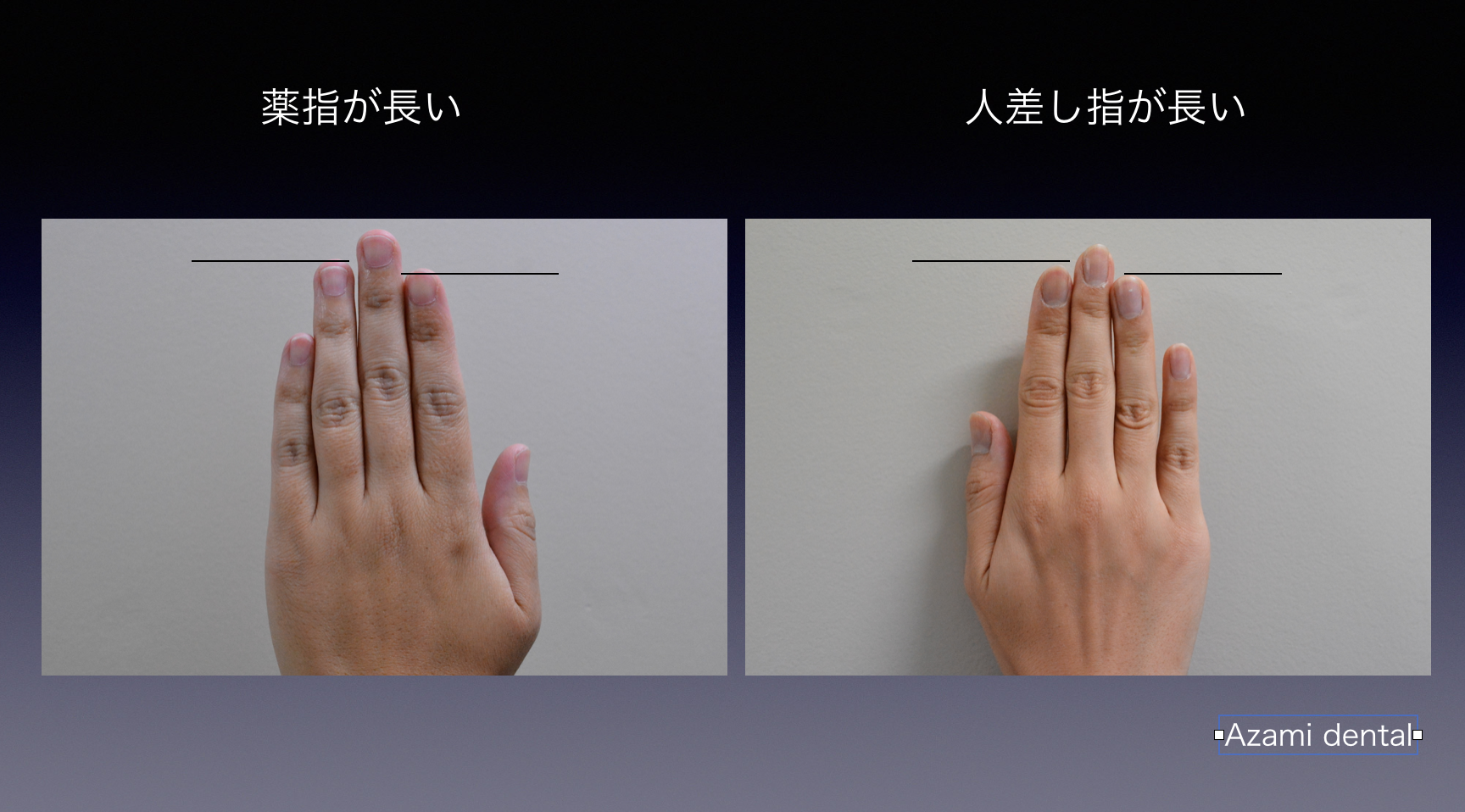 薬指が長い男性の割合は何％？人差し指との差やモテる理由を徹底解明