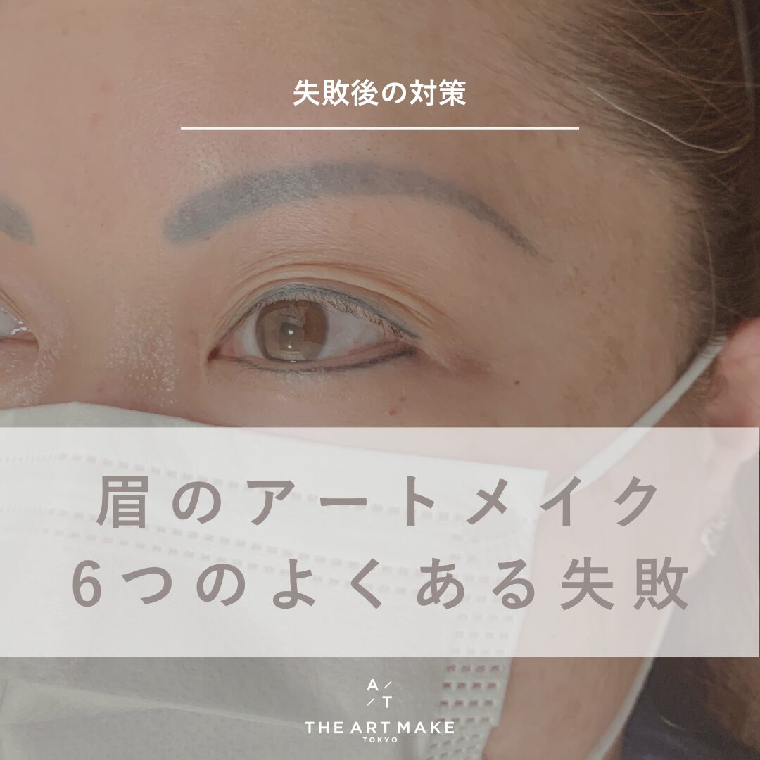 アートメイク失敗の真相と後悔の代償｜レーザー除去の費用と回避策